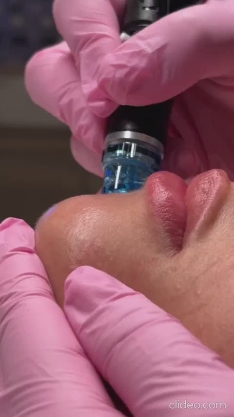 Load video: